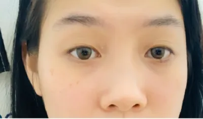 [Нүд] Гадаад эгч шиг - Нүд, хамар