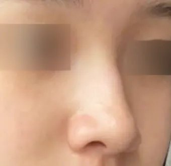 [Хамрын] Garib - Хамар