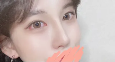 [Хамрын] Нонунгэжелжуоха - Нүд, Хамар, Духны өргөлт