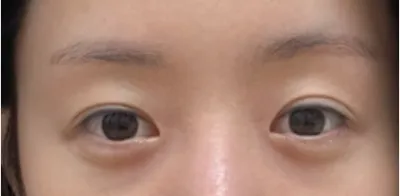 [Нүд] Гурван түмэн ли - Нүд