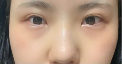 [Нүд] Пүпүнг - Нүд, хамар