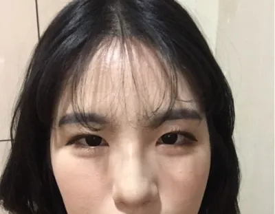 [Нүд] Чокчокан Чокочип - Нүд, Хамар