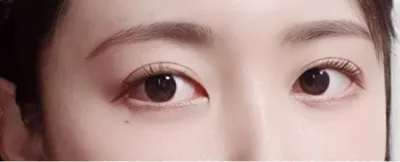 [Нүд] Район Чүншик - Нүд