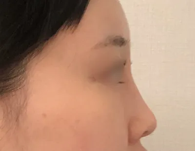 [Нүд] ЧокхоКейкү - Нүд, Хамар