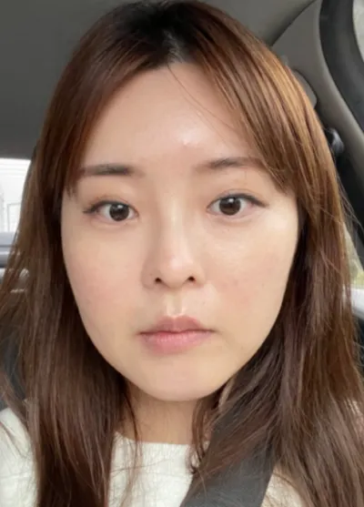 [Нүүрний хэлбэр засах мэс засал] Доктор Мойа - Нүд, хэлбэр, хамар, нүүрний өөх соруулах