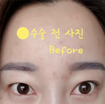 [Нүд] Америк Богино Үстэй - Нүд