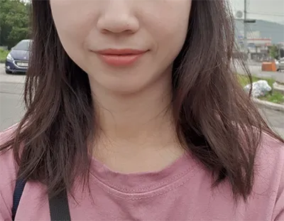 [Жижиг] Наранцэцэгssi - Шүрүнк, Контур Токс