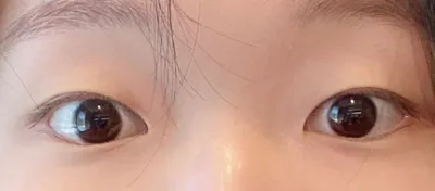 [Нүд] Яст Мэлхий - Нүд