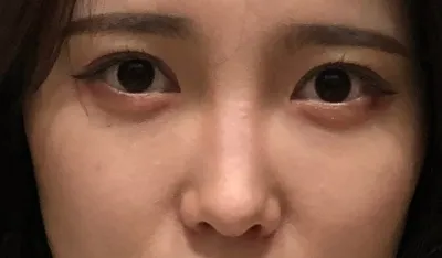 [Хамрын] Нарны гэрэл - Хамар