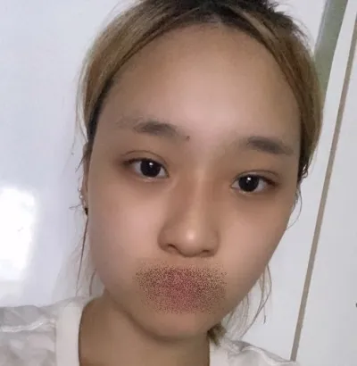 [Нүүрний контур] Иклипс - Нүд, хамар, контур