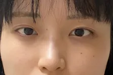 [Нүд] Бов Бов - Нүд, Хамар