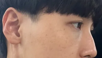 [Нүүрний контур]-ын хоёр сарын дараах байдал - Нүд, хамар, контур