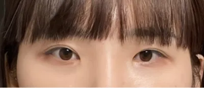 [Нүд] Daily Eye - Нүд