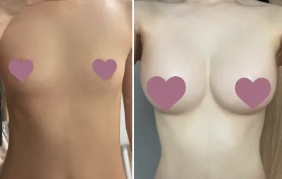 [Цээж] Эргүүлээд дээшээ - Цээж