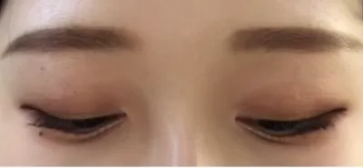 [Нүд] Шарсан загас - Нүд