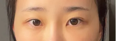 [Нүд] Цуу яриа сонссон - Нүд