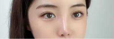 [Нүд] Маймелос - Нүд, Хамар