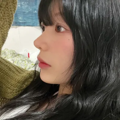 [Хамрын мэс засал] Марилин - Хамрын нуруу, үзүүр, бөхтэй хамар