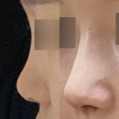 Хамарны анхны хагалгаагаа Weavers-т хийлгэсэн