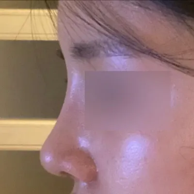 Би Сер Сунг-жо эмчид хагалгаанд ороод сар болж байгаа тухайгаа бичиж байна