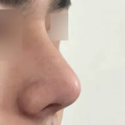 Шим Жон Хван эмчид хагалгаанд ороод 1 сар боллоо.