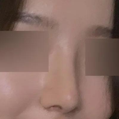 Вийверст мэс засал хийлгэснээс хойш яг 2 сар боллоо