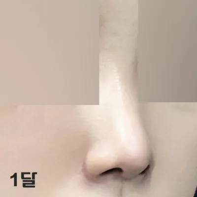 Нэг сар болоход хавагнах нь бүр ч их арилж байгаа юм шиг байна.