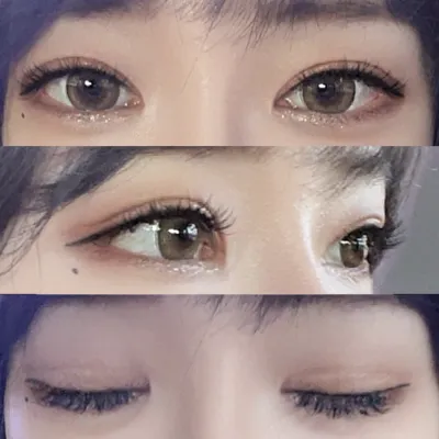 Нүдний дахин хагалгаанд ороод 4 сар өнгөрчээ.