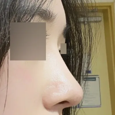 Би Сим Жон Хван эмчид хагалгаа хийлгээд 4 сар боллоо!