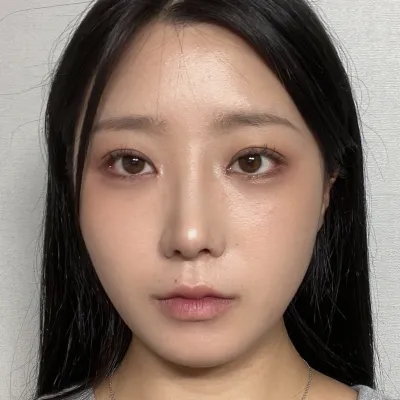 Мэс засал хийлгэснээс хойш сар гаруй болж байна~