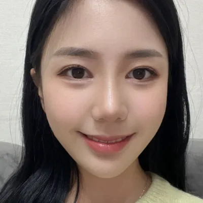 Хамрын мэс засал, нүдний дахин мэс засал хийлгэснээс хойш 3 сар өнгөрч байна