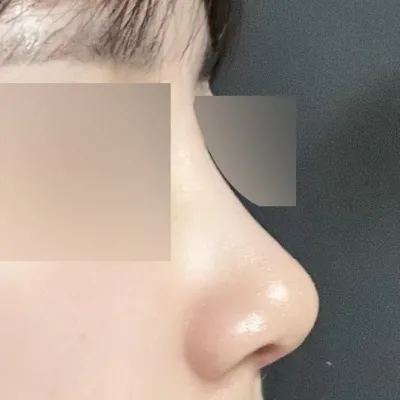 Миний цогцолбор байсан хамар маань сайхан болсон!