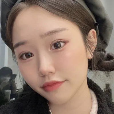 Нүдний хагалгаа хийлгэснээс хойш 2 сар болж байна ~