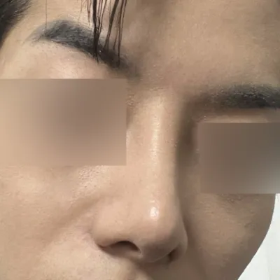 Том хамартаа дахин хагалгаа хийлгэсэндээ үнэхээр сэтгэл хангалуун байна.