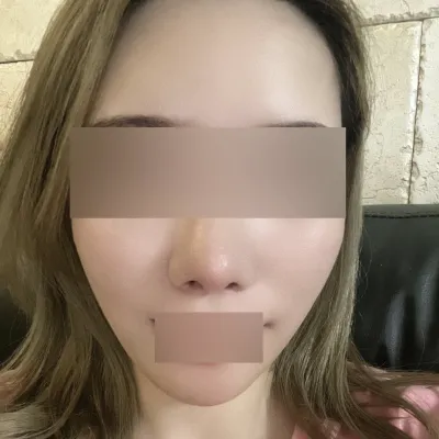 Утас татах эмчилгээ хийлгэснээс хойш хоёр сар боллоо ~