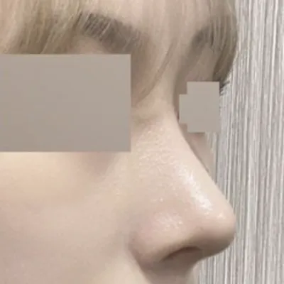 Мэс засал хийлгээд 2 сар болж байна даа!!