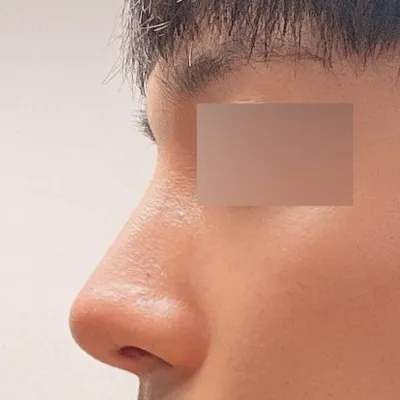 Вийверс гоо сайхны мэс заслын эмнэлэгт хагалгаанд ороод зургаан сар болж байна