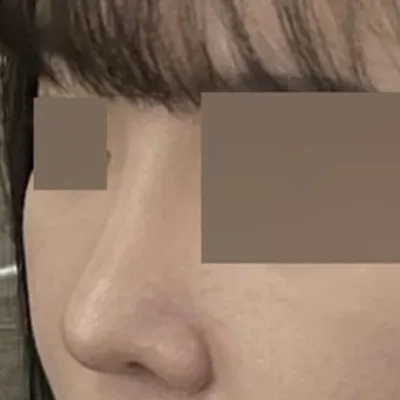 Мэс засал хийлгээд аль хэдийн 4 сар болжээ!! ㅎㅎ