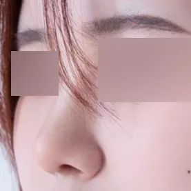 Хэрэв та хамарны талаар санаа зовж байгаа бол маш ихээр зөвлөж байна ~