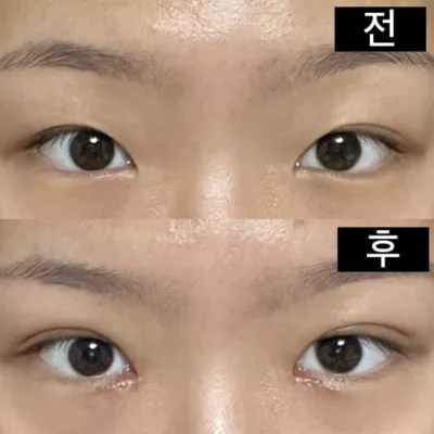 Өмнөх ба дараах бүх зургийг үндсэн камераар авсан!