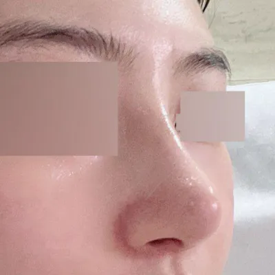 Миний хүссэн хамар хийлгэсэн Со Сын Жо эмчид баярлалаа!