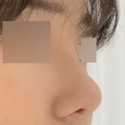 Бүгд байгалийн, өндөр сайхан болсон гэж хаана хийлгэсэн бэ гэж асуудаг~~~