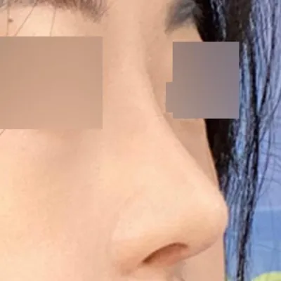 Мэс засал хийлгэснээс хойш 2 сар болж байгаа ч үнэхээр сэтгэл хангалуун байна.