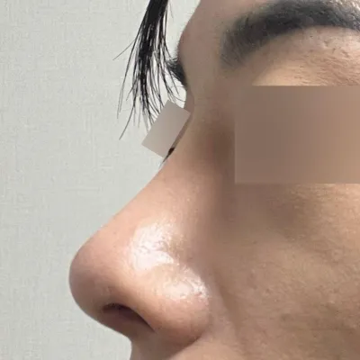 Давтан мэс засалд орохоор төлөвлөж байгаа хүмүүс Шим эмчид заавал очоорой