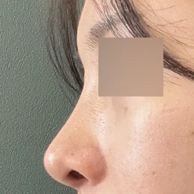 Дахиад хийлгэх бол 100% Со Сынжо захирал!!