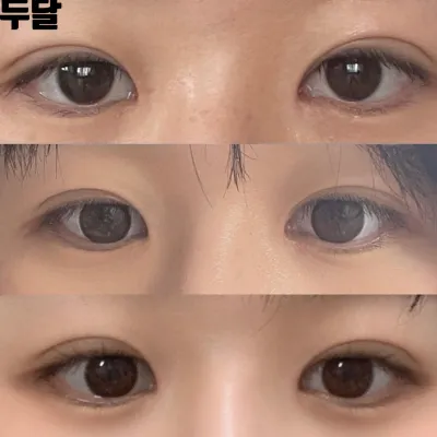 Сэтгэгдлээ үлдээж байна: Шим Жун Хван эмчид хамар, нүдний мэс засалд ороод хоёр сар болж байна