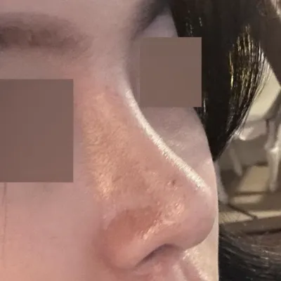 Эргэн тойрныхоо хүмүүсээс хамар чинь ямар гоё вэ гэж байнга сонсож байна даа, хехе