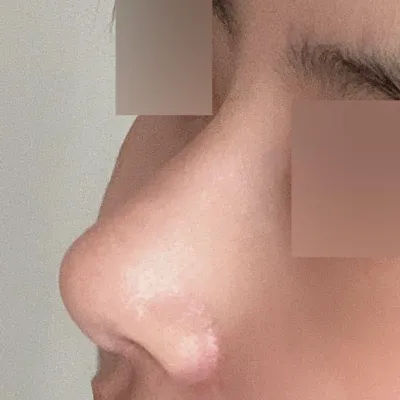 Одоо бол би бүдүүн хамартайгаа бүрэн салах ёстой байх аа хаха