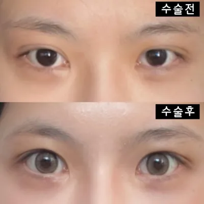 Виверс гоо сайхны мэс заслын эмнэлэгт хагалгаанд ороод хоёр сар болж байна даа ~