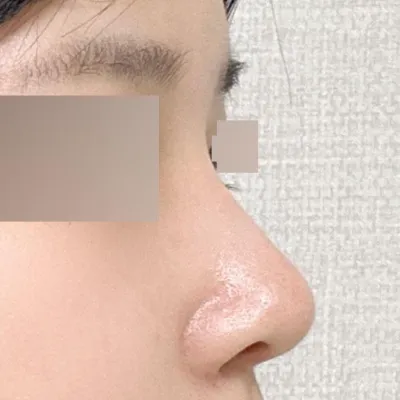 Вийверс гоо сайхны мэс заслын эмнэлэгт хагалгаанд ороод хоёр сар болж байна даа~